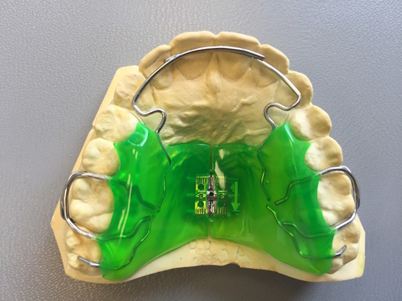 mykie®, Maximilian Schreiner, Kieferorthopädie California Smile München