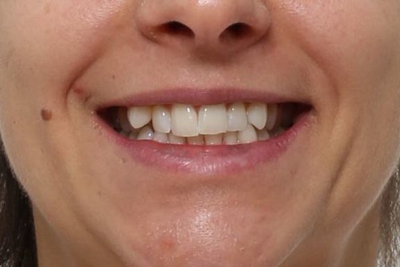 magazin black corridors california smile kieferorthopädie münchen