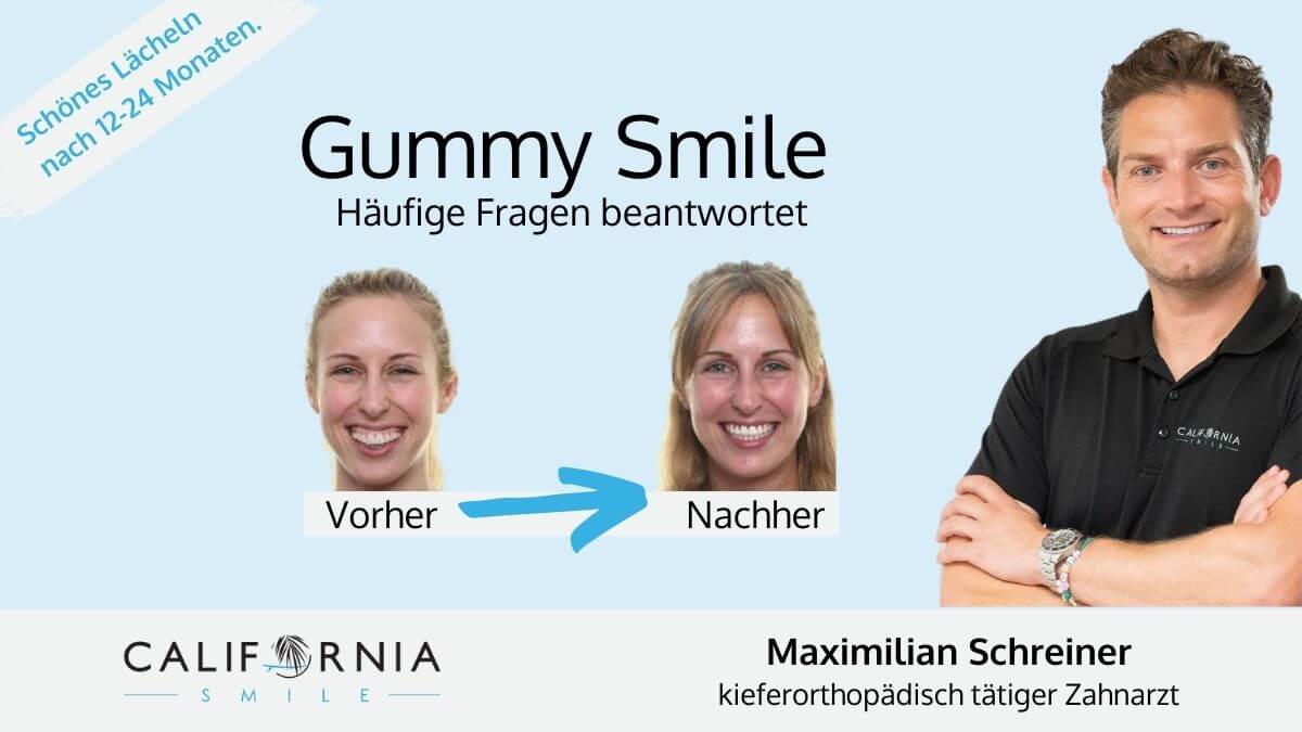 gummy smile münchen kieferorthopäde california smile maximilan schreiner